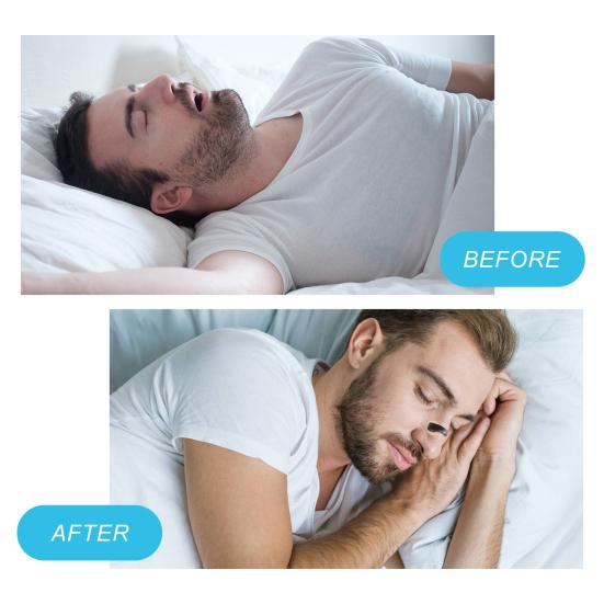 جهاز تحسين التنفس nasal dilatateur (30 يوم)